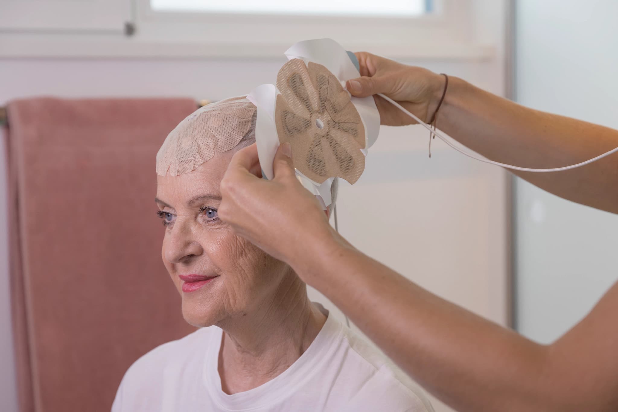 Illustration of glioma brain tumor treatment with focus on tumor location in brain